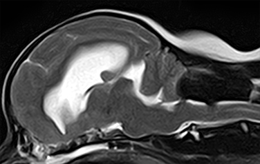 Chiari-like malformation