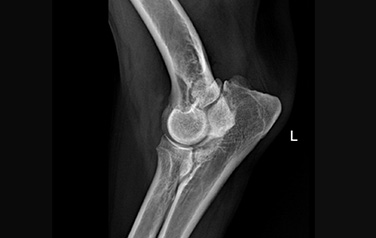 Elbow ununited anconeal process