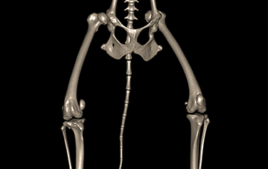 ESF (External Skeletal Fixation)